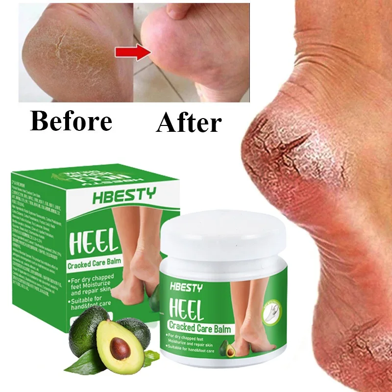 Description Picture 3 of itemAvocado Anti Crack Foot Cream Herbal Anti-Drying Heel Chapped Repair Balm Dead Skin Remove Foot Mask Moisturizing Hand Feet Care