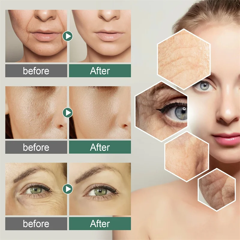 Description Picture 6 of item30ml Glycerol Vitamin c Boost Serum Anti-Aging Dark Spot Corrector Wrinkle Cream Women Face Skin Care