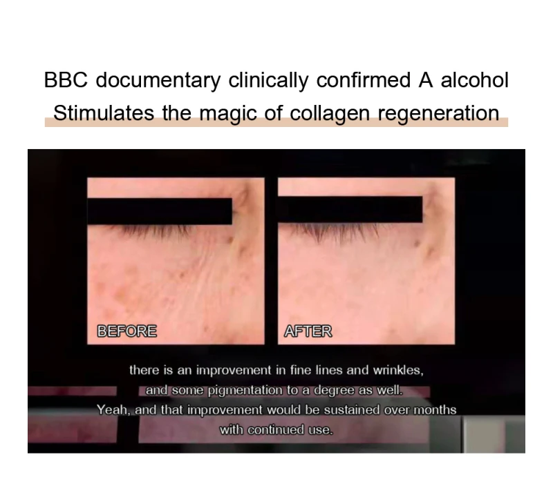 Description Picture 6 of itemRetinol Anti Wrinkle Face Cream Anti-Aging Remove Wrinkle Firming Lifting Whitening Moisturizing Facial Skin Care Korean Cosmeti