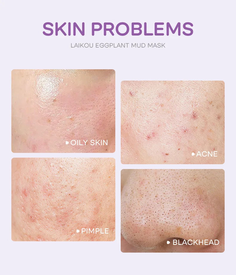 Description Picture 6 of item5pcs LAIKOU Eggplant Mud Mask Oil Control Moisturizing Anti-Acne Anti Wrinkle Whitening Cleansing Clay Mask Skin Care Face Mask