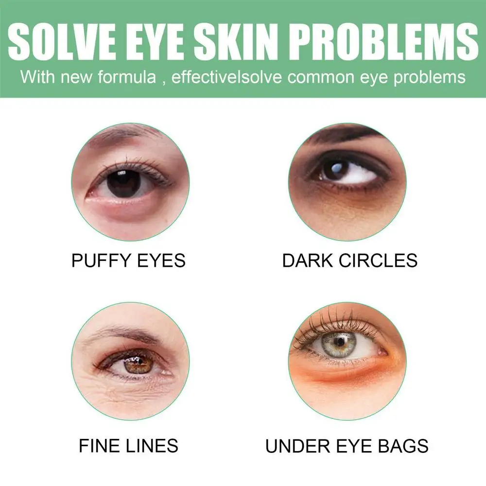 Description Picture 5 of itemEye Patch For Puffiness 30 Pairs Aloe Dark Circles All Cover Eye Patch Women Eyelid Lifter Strips Reduce Dark Circles Under Eye