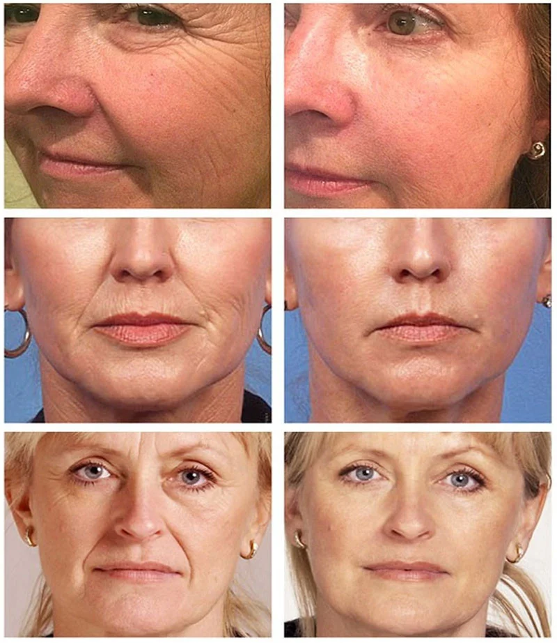 Description Picture 3 of itemRetinol Anti Aging Remove Wrinkles Serum Firm Facial Essence Fade Eye Fine Line Moisturizing Lift Brighten Face Skin Care Beauty
