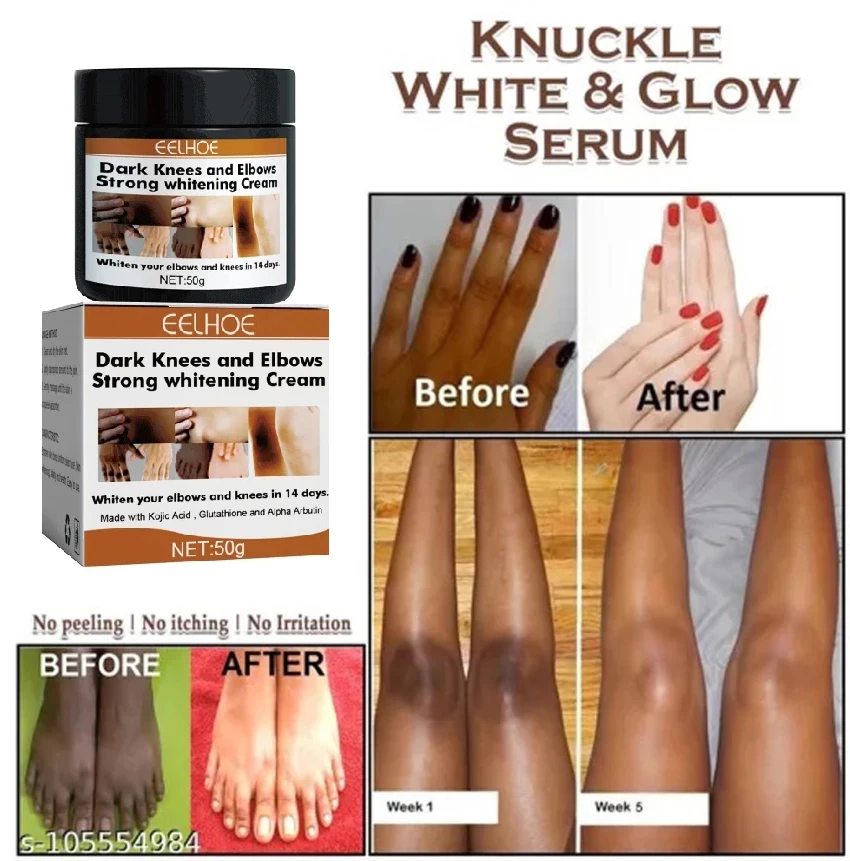 Description Picture 2 of itemFast Whitening Dark Knuckles Cream Pigmentation Correctors For Black Skin Hand Knuckle Elbows Knee Intense Stains Remover Cream