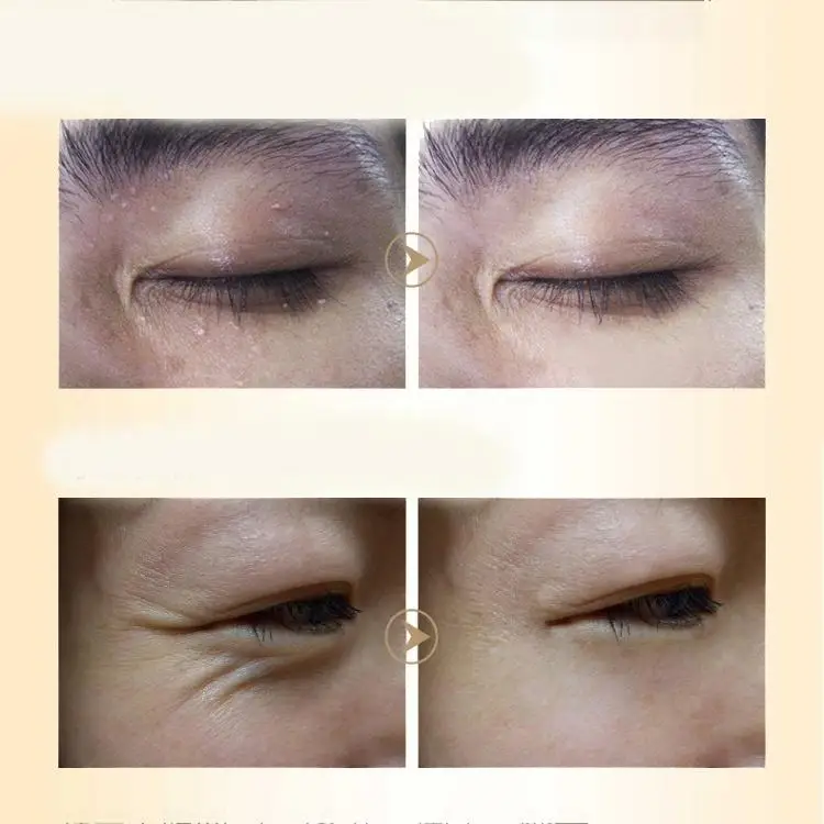 Description Picture 3 of itemHorse Oil Firming Eye Cream for Dark Circles&wrinkles& Fat Granule & Anti-aging Eye Essence Remove Dark Circles Eye Cream