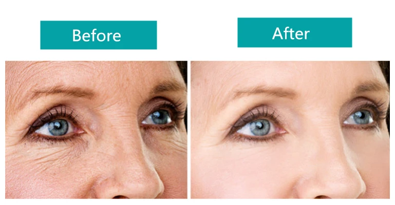 Description Picture 2 of item10pcs Eye Mask Instantly Eye Cream Moisturizing Crocodile Serum Remover Dark Circles Against Puffiness Bags