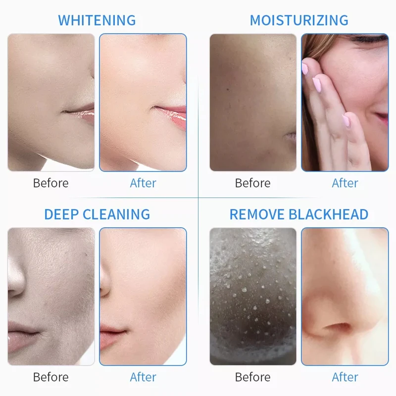 Description Picture 4 of itemAqua Peeling Solution Skin Clean Essence Product Serum For Hydra Facial Dermabrasion Skin Care Beauty Machine