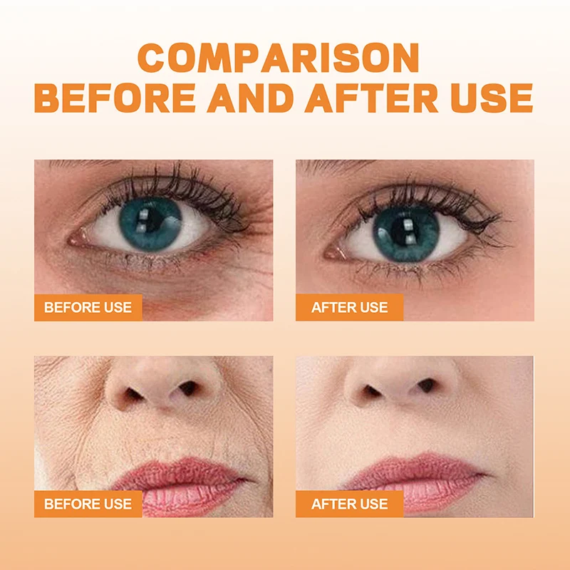 Description Picture 6 of itemNew Facial High-Protein Collagen Film Water-Soluble Mask Fades Dark Circles Eye Bags Eye Mask Light Fine Lines Lifting Firming