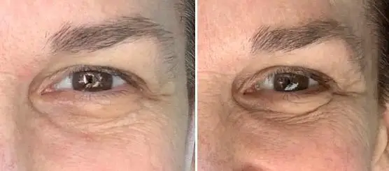Description Picture 3 of itemFacial Lifting and Firming High-Protein Collagen Film Water-Soluble Mask Fades Dark Circles Eye Bags Eye Mask Light Fine Lines