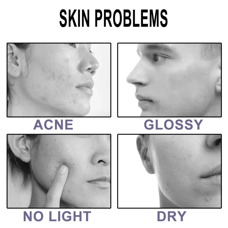 Description Picture 5 of itemMasks Solid Cleans Deep Cleansing Pore Remove Blackhead Acne Mud Film Oil Control Moisturizing Solid Smear Type Masks Skin Care