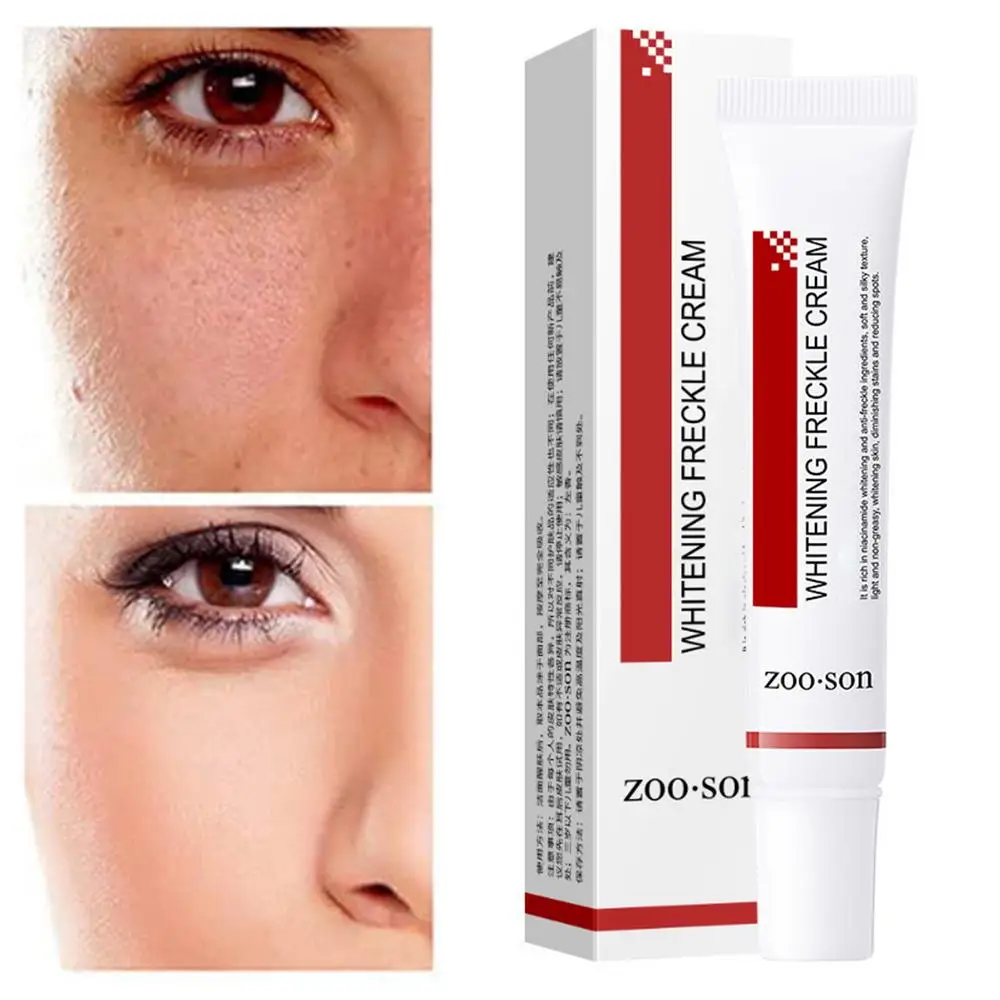 Description Picture 5 of itemPigmentation Removal Cream Mild Dark Spot Remover Safe Skin Lightening Cream For Dark Skin Effective Hydrating Moisturising