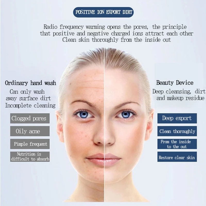 Description Picture 4 of itemFacial Mesotherapy Electroporation RF&EMS Radio Frequency Photon Face Lifting Tighten Wrinkle Removal Skin Care Tools