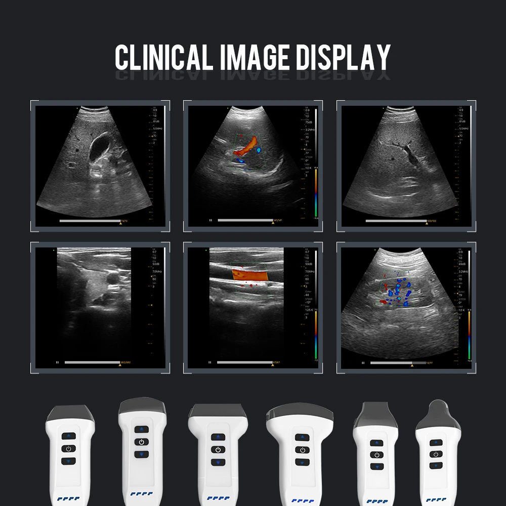 Support Android ISO Color Doppler Linear Convex Dual Probe 2 In 1 Pocket Wireless Handheld Ultrasound Scanner for ABD GYN OB....