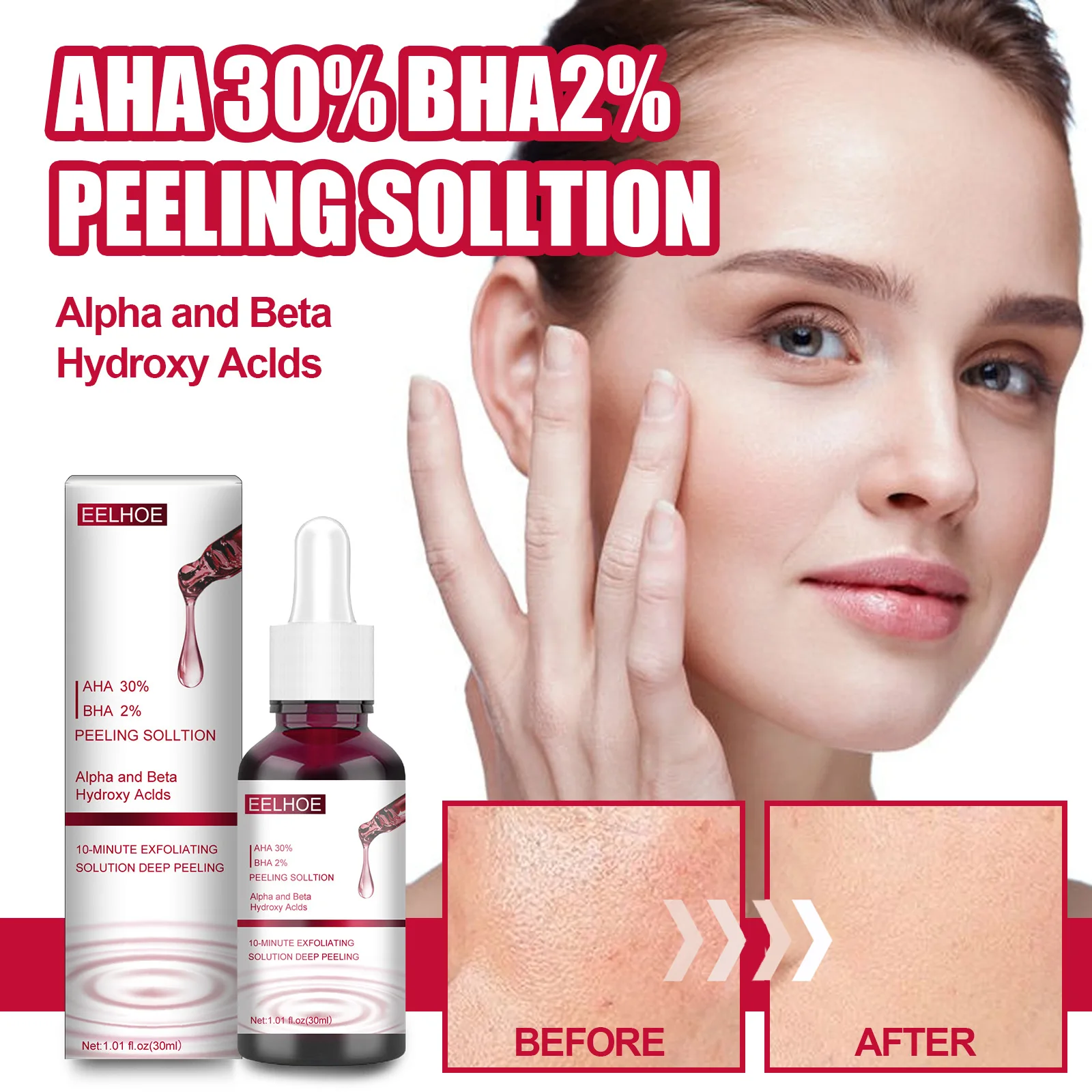 Description Picture 6 of itemFace Peeling Solution AHA 30% + BHA 2% Fruit Acid Salicylic Acid Acne Treatment Serum Hyaluronic Acid Repair Face Skin Care 30ml
