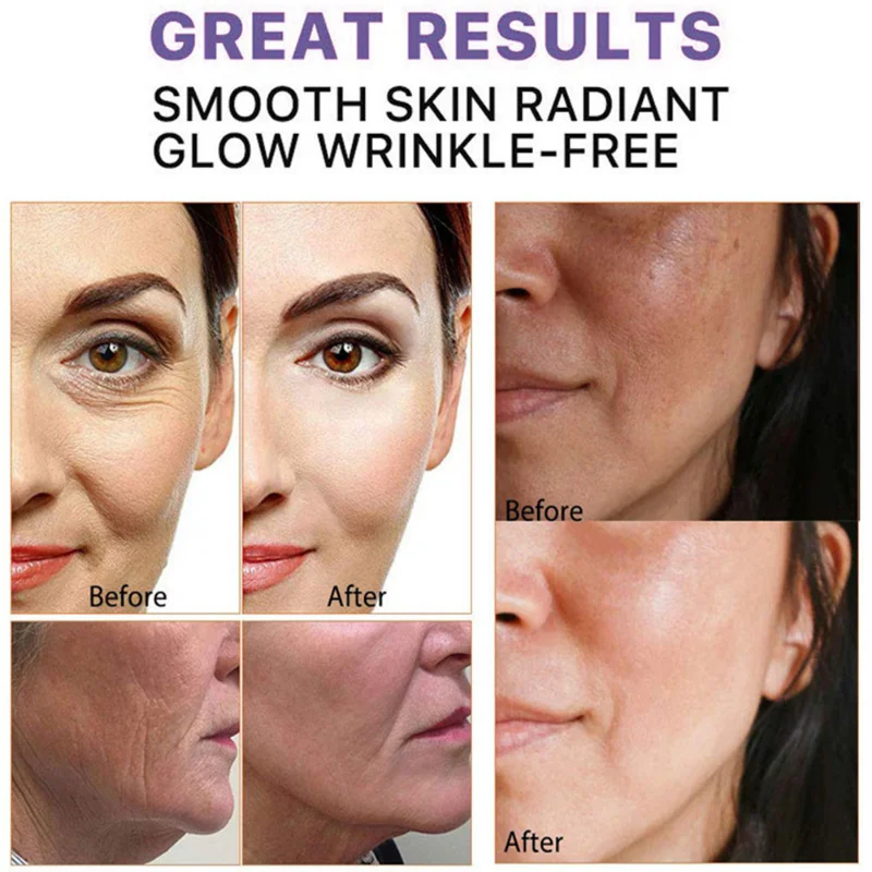 Description Picture 3 of item5 Seconds Retinol Wrinkle Remover Face Cream Anti-Aging Firm Lifting Fade Fine Line Improve Puffiness Whiten Women Men Skin Care