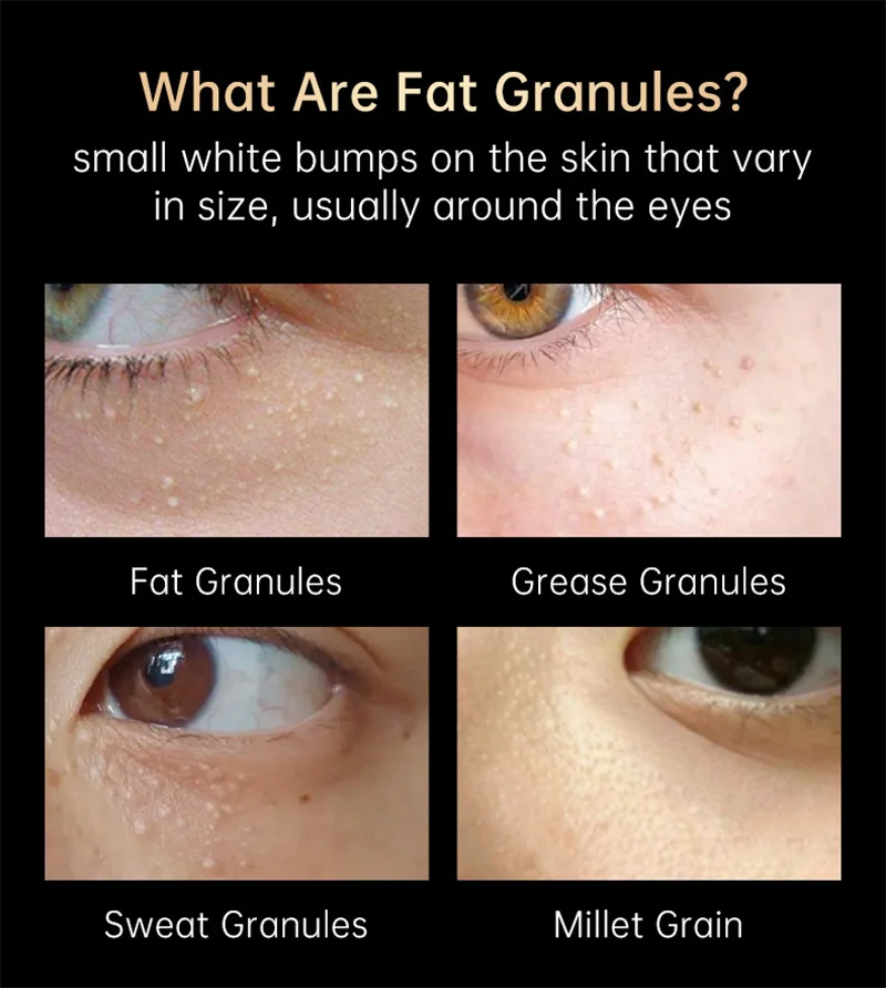 Description Picture 5 of itemRemoval Fat Particles Eye Mask Remove Eye Bags Dark Circles Fade Fine Lines Anti Aging Moisturizing Beauty Eye Care Products 15g