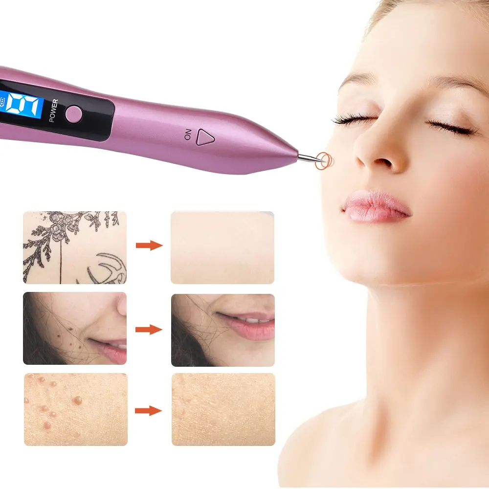 Description Picture 5 of itemMole Removal Pen