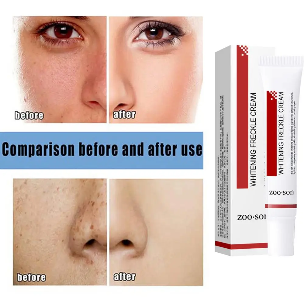Description Picture 6 of itemPigmentation Removal Cream Mild Dark Spot Remover Safe Skin Lightening Cream For Dark Skin Effective Hydrating Moisturising