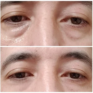 Description Picture 2 of itemFacial Lifting and Firming High-Protein Collagen Film Water-Soluble Mask Fades Dark Circles Eye Bags Eye Mask Light Fine Lines