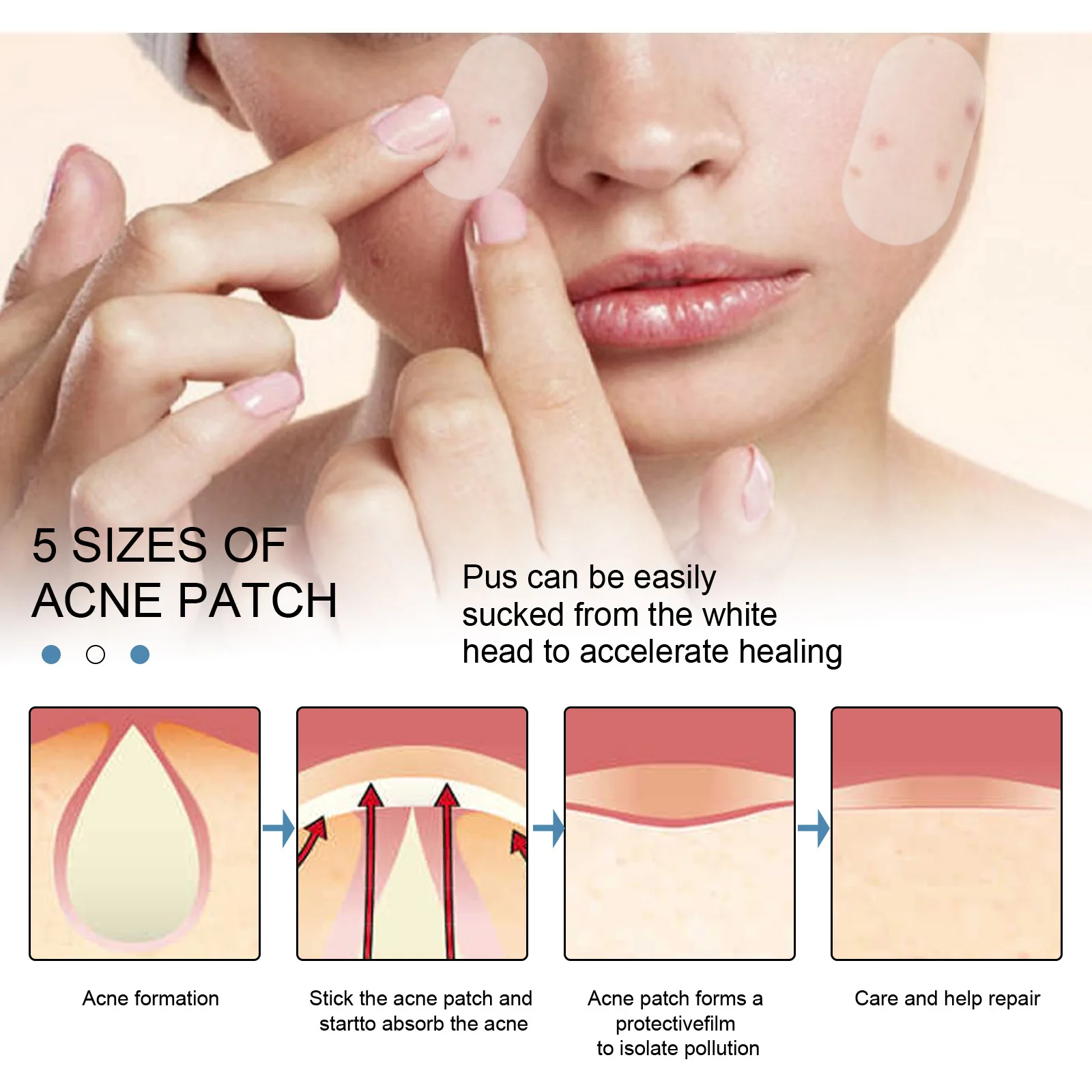 Description Picture 6 of item36/80pcs Acne Pimple Sticker Invisible Hydrocolloid Acne Removal Treatment Patch Waterproof Black Head Remover Facial Skin Care