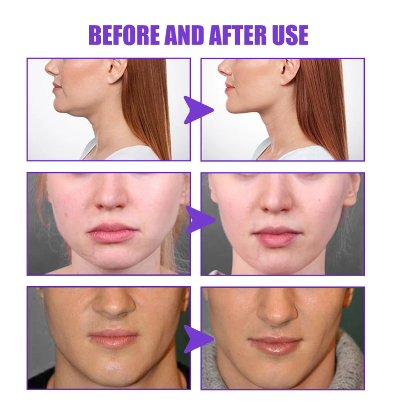 Description Picture 5 of itemEffective Face V Shape Lift Cream Remove Double Chin Slimming Firm Contouring Massage Cream Face Fat Burn Anti Aging Beauty Skin