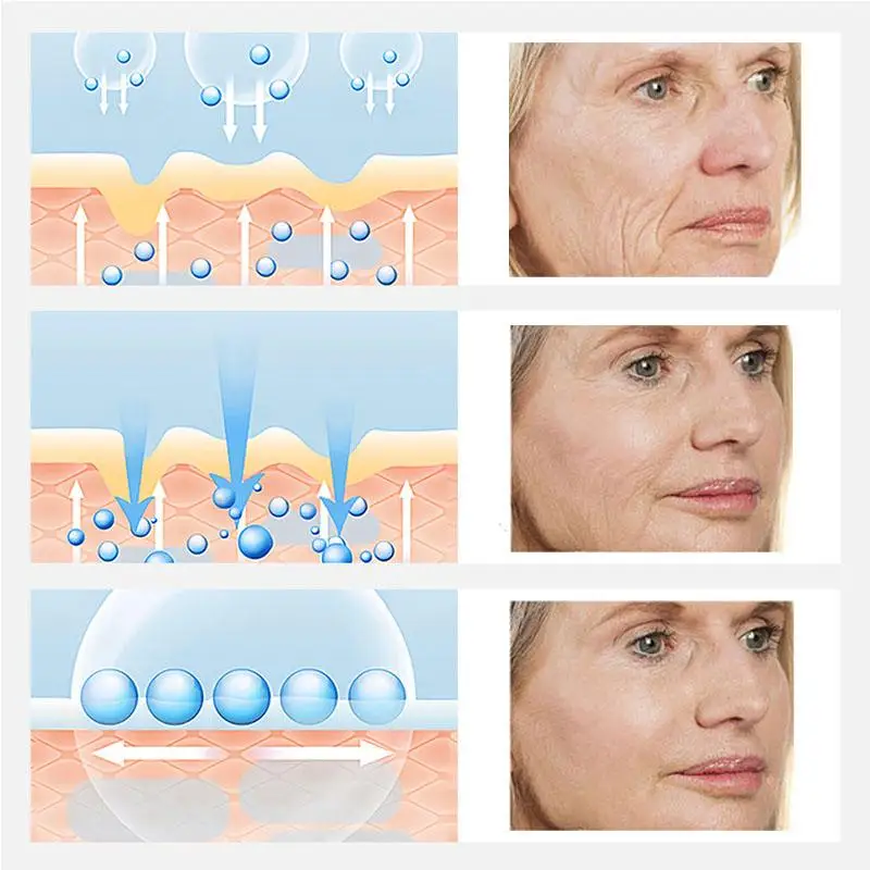 Description Picture 5 of itemRetinol Serum Anti-Aging Lifting Firming Collagen Facial Essence Remove Wrinkles Relieve Fine Lines Repair Tighten Skin