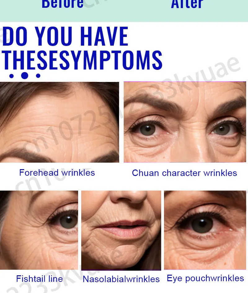 Description Picture 4 of itemEffective Anti-Ageing And Anti-Wrinkle Facial Serum To Remove Facial Wrinkles Fine Lines Around The Eyes Crow's Feet Neck Wrinkl
