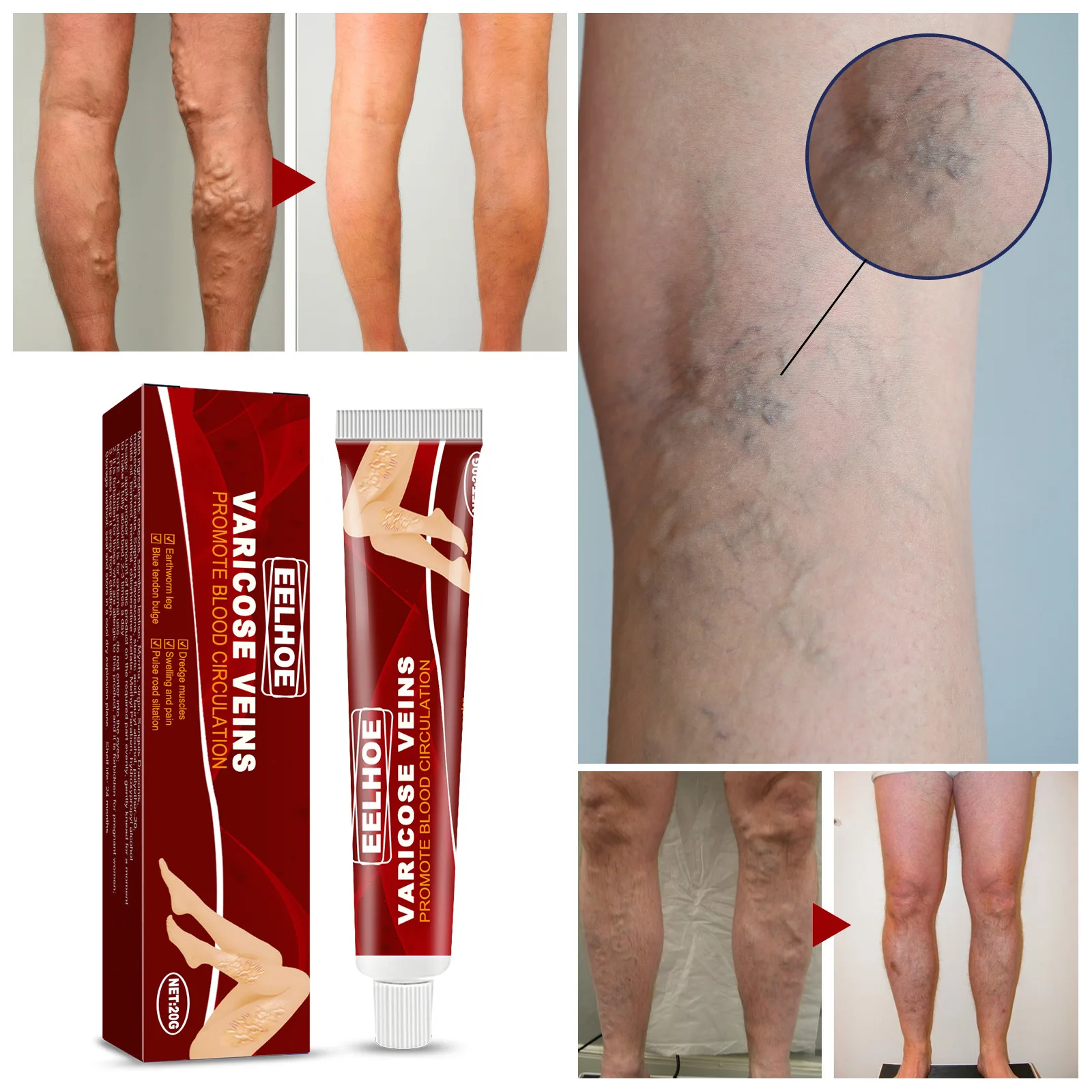 Description Picture 3 of item20g Venous Massage Varicose Balm Relieves Bulge Blood Vessels in The Legs Calf Swelling Earthworm Leg Vein Massage Balm Cream