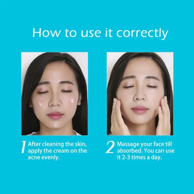 Description Picture 4 of itemAcne Treatment Cream Moisturizing Control Oil Shrinking Pores Remove Marks Pimple Removal Product