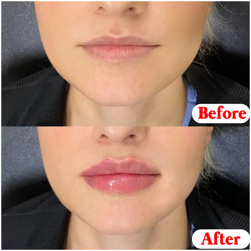 Description Picture 3 of item6Pcs Lip Balm Hydrating Nourishing Lips Balm Long Lasting Natural Botanical Anti-Cracked Lip Treatment Vaseline Lip Care Cream