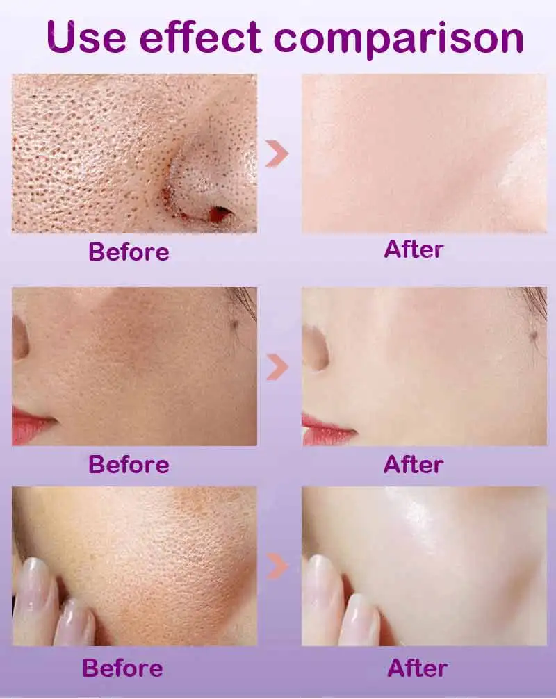 Description Picture 5 of itemPore Skin Care Serum Facial Essence for Shrinking Pores Relieving Dryness Moisturizing Oil Control Firming