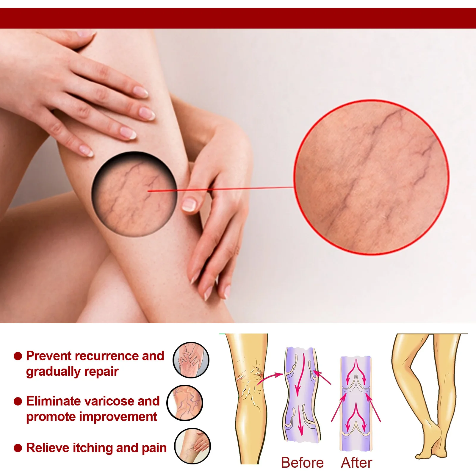 Description Picture 5 of item20g Venous Massage Varicose Balm Relieves Bulge Blood Vessels in The Legs Calf Swelling Earthworm Leg Vein Massage Balm Cream