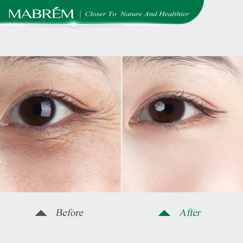 MABREM Rich delicate eye cream Bright detailed Anti-Puffiness Anti Dark Circle Remove wrinkles Soft Moisturizing Eye cream 15g