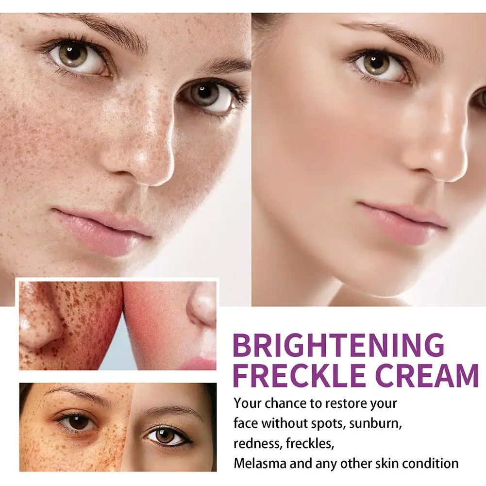 Description Picture 6 of itemWhitening Freckles Cream Remove Melasma Dark Spot Lightening Removal Melasma Remover Moisturize Brighten Face Skin Care