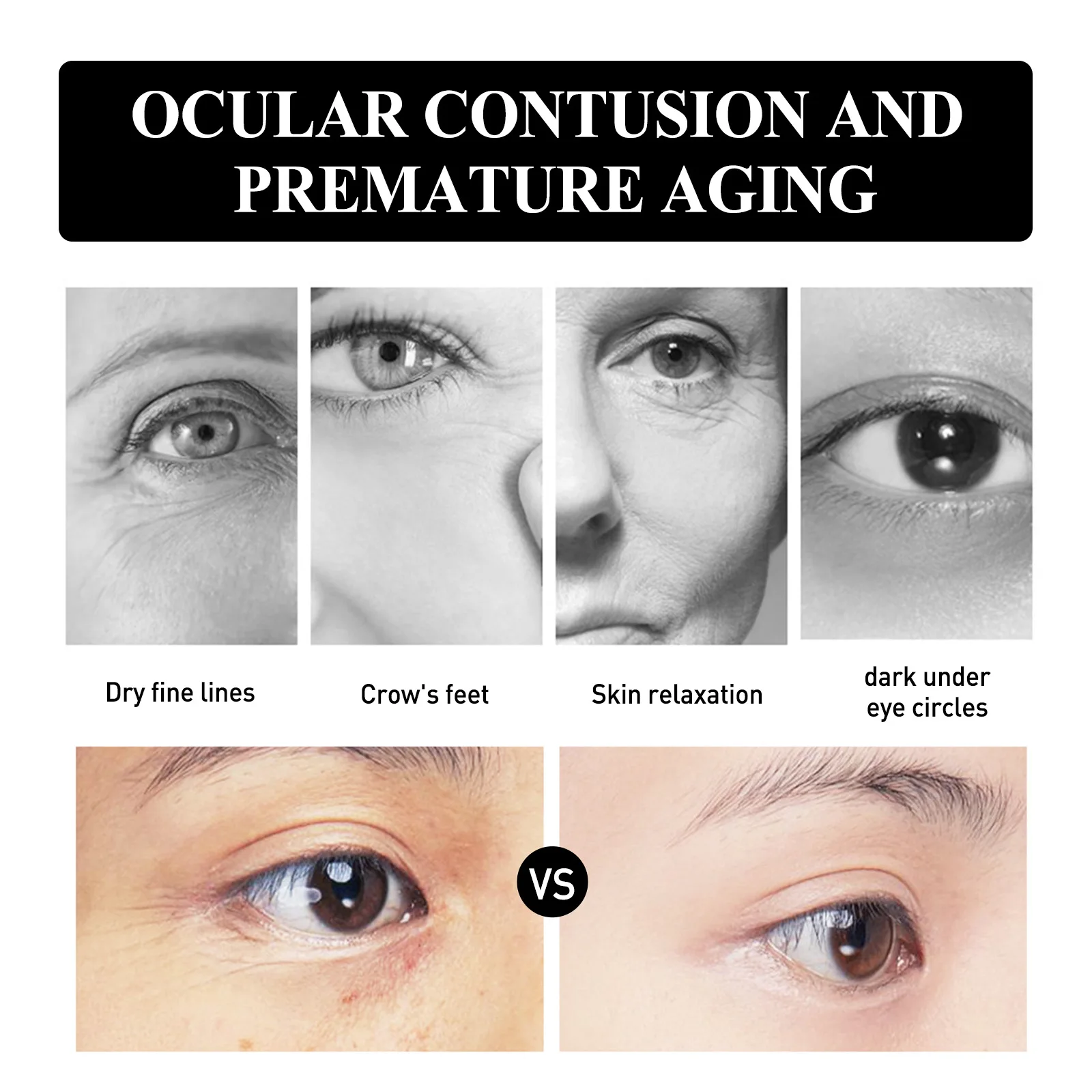 Description Picture 5 of item1/3Pairs Collagen Micro-needle Eye Mask Patches Anti-wrikles Remove Dark Circles Eye Bags Moisturizing Eye Skin Firming Mask Set