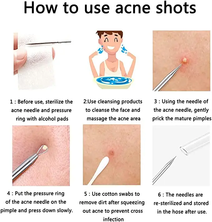 Description Picture 4 of item5 PCS Blackhead Remover Comedones Extractor Acne Removal Kit for Blemish, Whitehead Popping, Zit Removing for Nose Face Tools