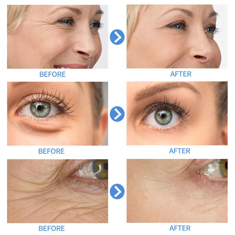 Description Picture 5 of itemRetinol Anti Aging Remove Wrinkles Serum Firm Facial Essence Fade Eye Fine Line Moisturizing Lift Brighten Face Skin Care Beauty