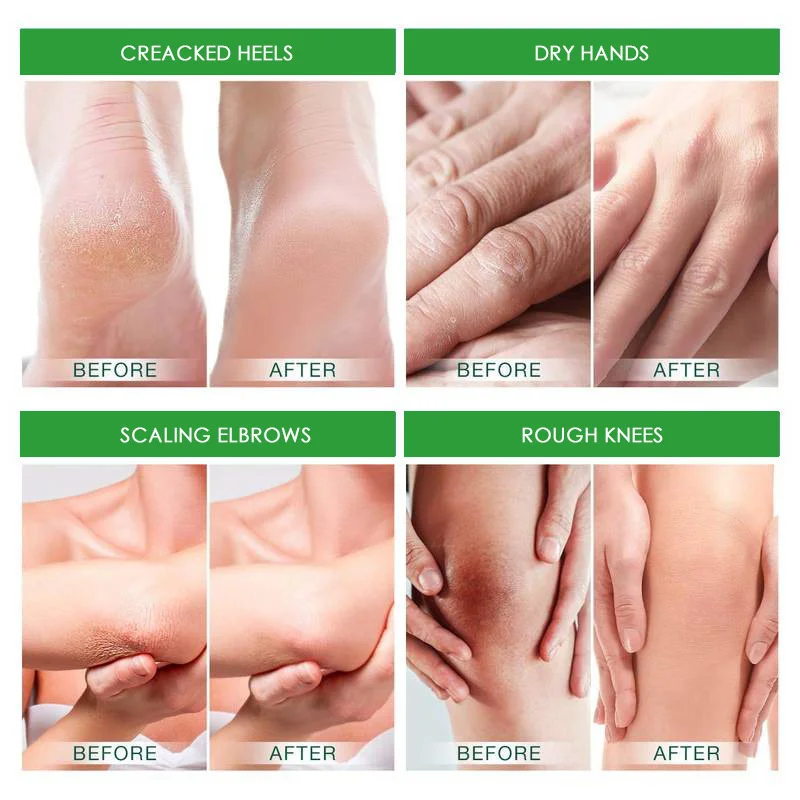 Description Picture 5 of itemAvocado Anti Crack Foot Cream Herbal Anti-Drying Heel Chapped Repair Balm Dead Skin Remove Foot Mask Moisturizing Hand Feet Care