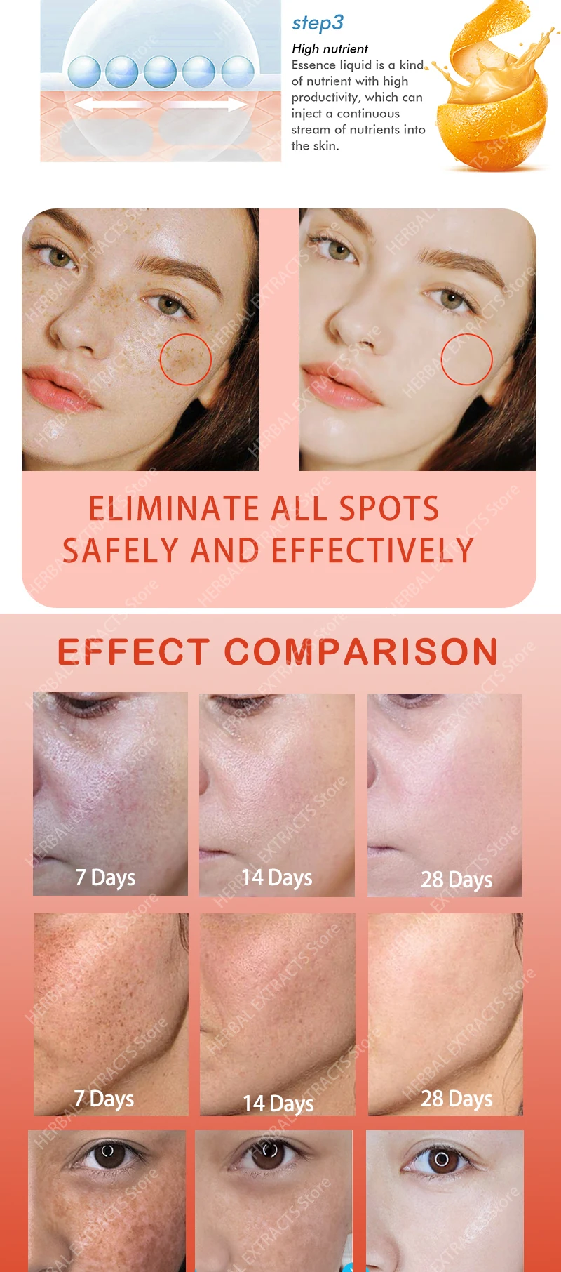 Description Picture 6 of itemdark spot remover Melasma Chloasma black spots cream
