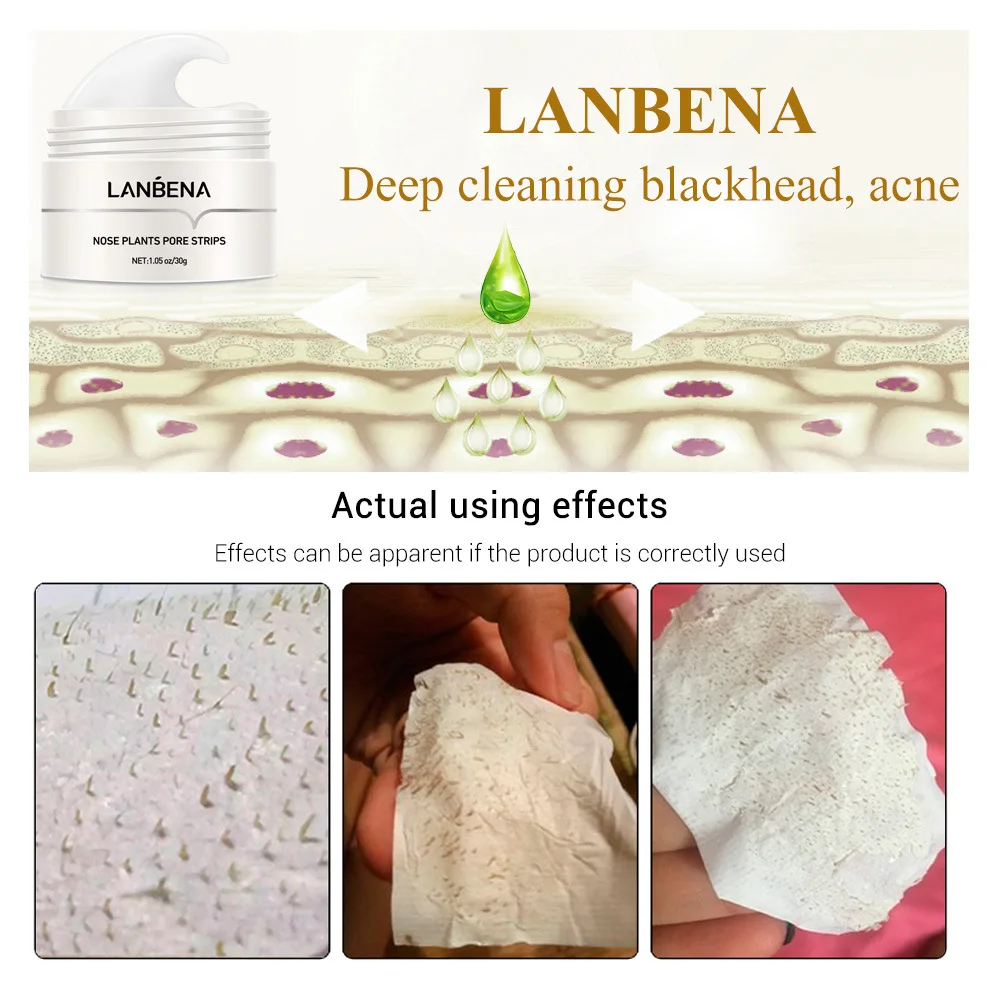 Description Picture 6 of itemLANBENA Pore Cleaner Nose Peel Blackhead Remover Face Deep T Zone Acne Pimple Removal Facial Diamond Beauty Care SPA Skin Cream