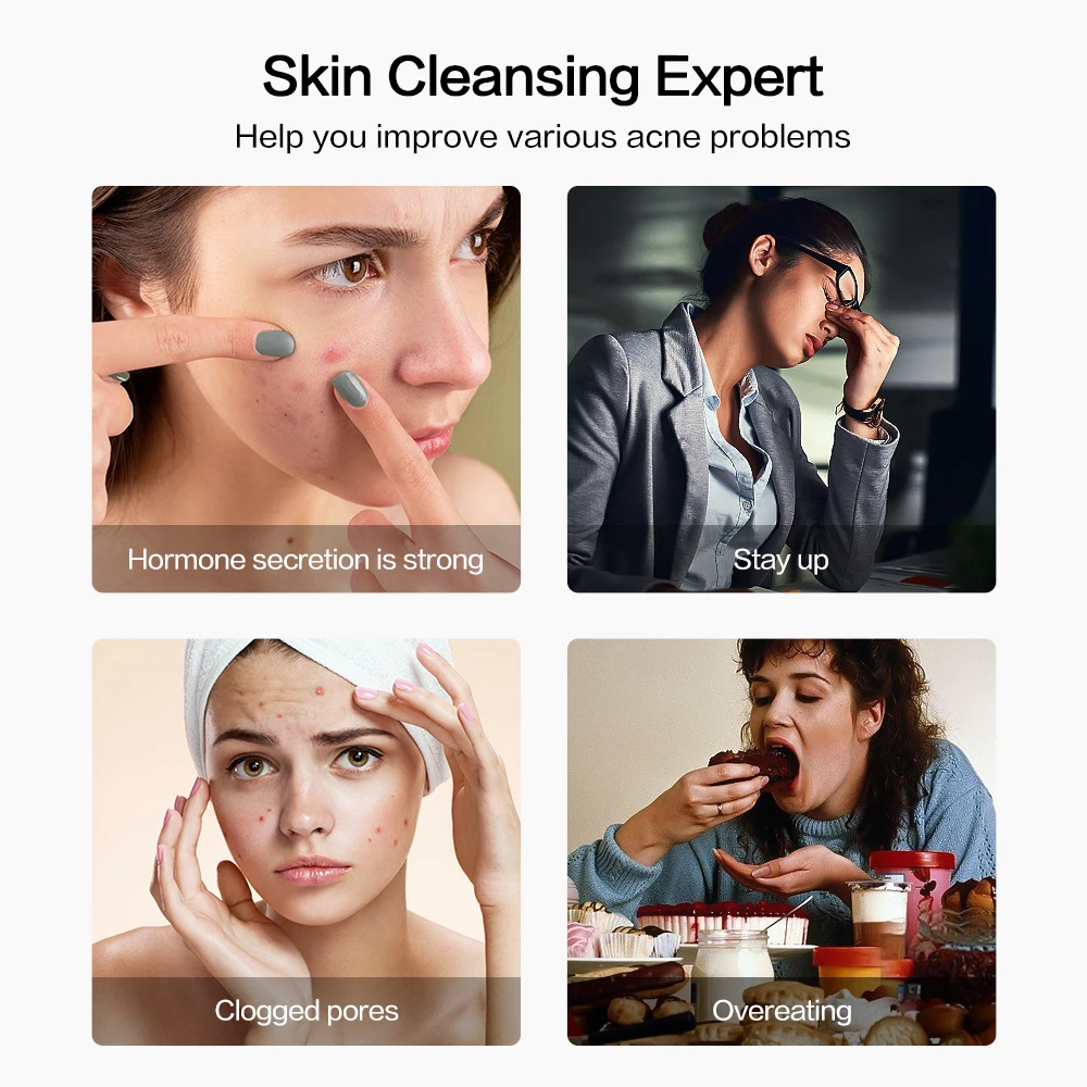 Description Picture 3 of itemSmart Visual Blackhead Remover Acne Needle 500W HD Camera Comedones Extractor Deep Pore Cleaner Skin Care Pimple Removal Tool