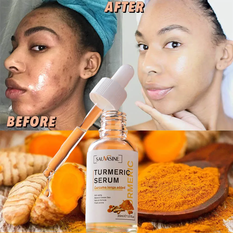 Slide image undefined