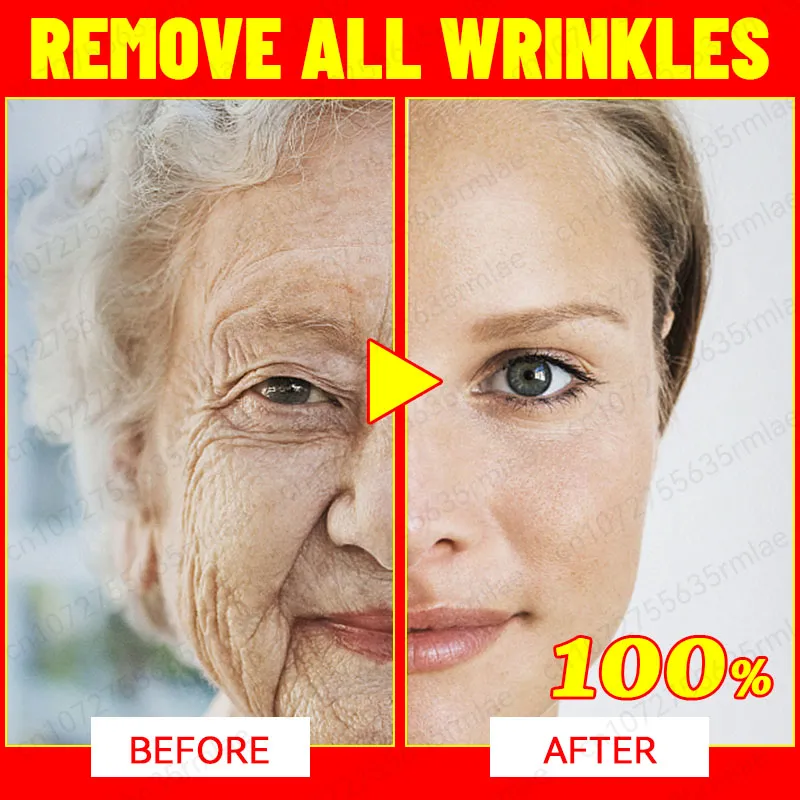 Effective Anti-Ageing And Anti-Wrinkle Facial Serum To Remove Facial Wrinkles Fine Lines Around The Eyes Crow's Feet Neck Wrinkl