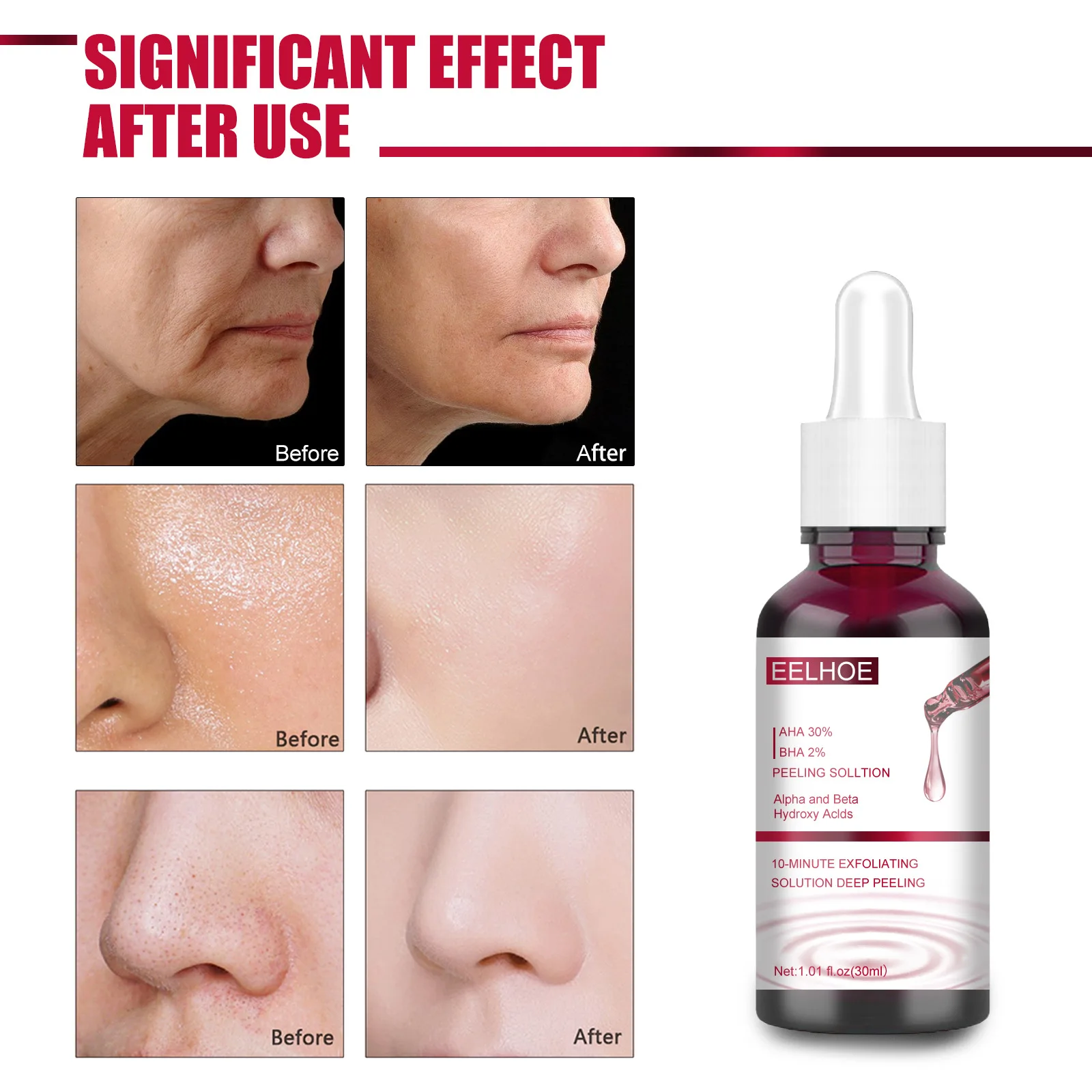 Description Picture 3 of itemFace Peeling Solution AHA 30% + BHA 2% Fruit Acid Salicylic Acid Acne Treatment Serum Hyaluronic Acid Repair Face Skin Care 30ml