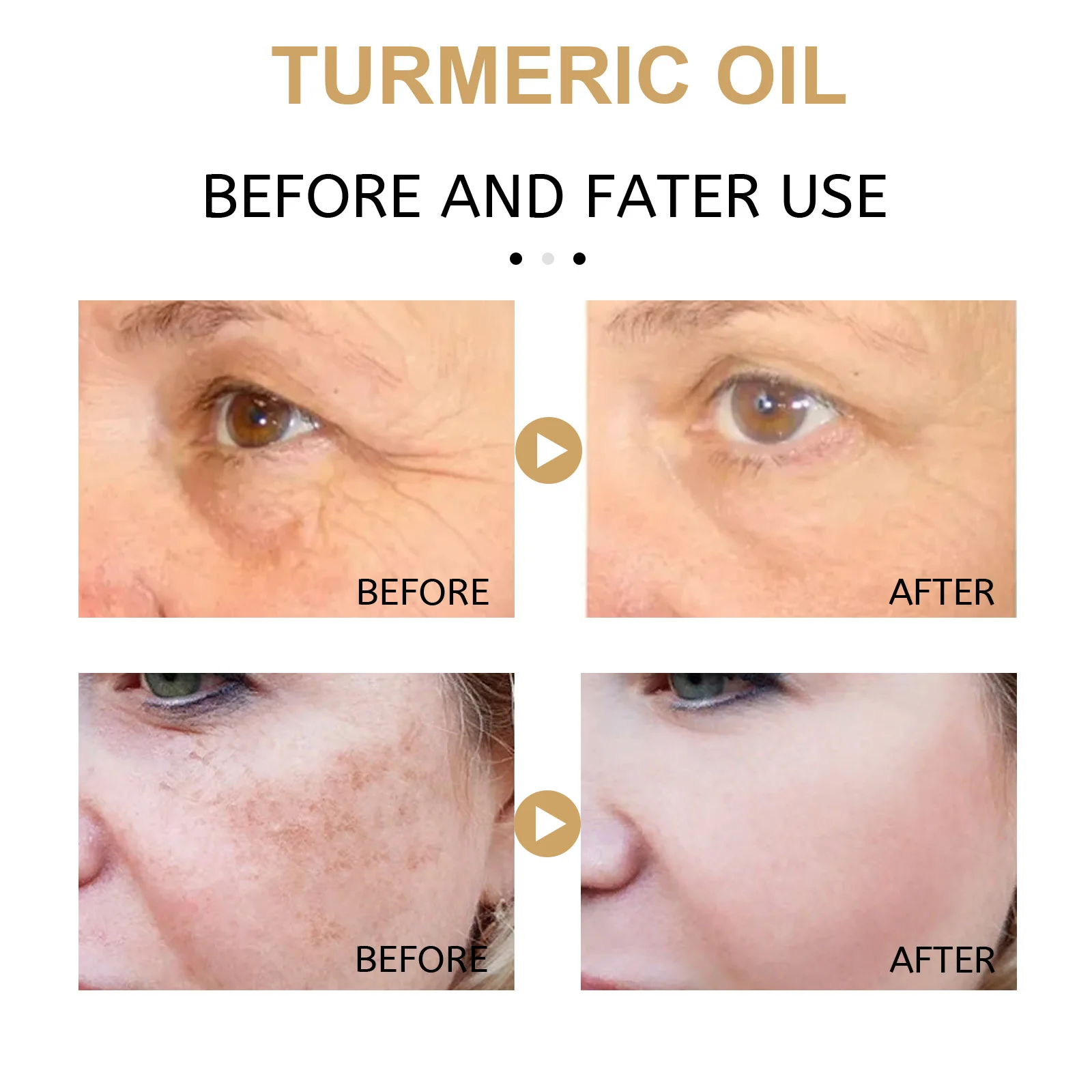 Description Picture 5 of itemTurmeric Freckle Whitening Serum Curcumin Oil Brighten Fade Dark Spot Removal Pigment Melanin Correcting Beauty Face Skin Care