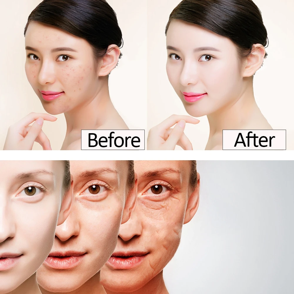 Description Picture 5 of itemFacial Mesotherapy Electroporation RF&EMS Radio Frequency Photon Face Lifting Tighten Wrinkle Removal Skin Care Tools