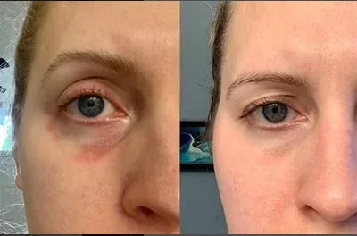 Description Picture 6 of itemFacial Lifting and Firming High-Protein Collagen Film Water-Soluble Mask Fades Dark Circles Eye Bags Eye Mask Light Fine Lines