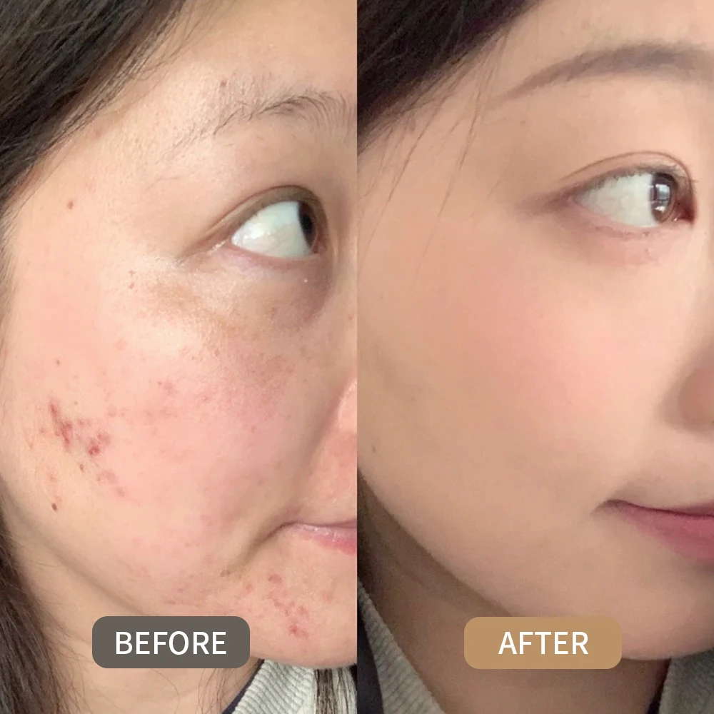 Description Picture 2 of item1PC High Coverage Concealer Palette Corrector Anti Dark Circle Freckle Waterproof Foundation Cream for Face Makeup Base Cosmetic