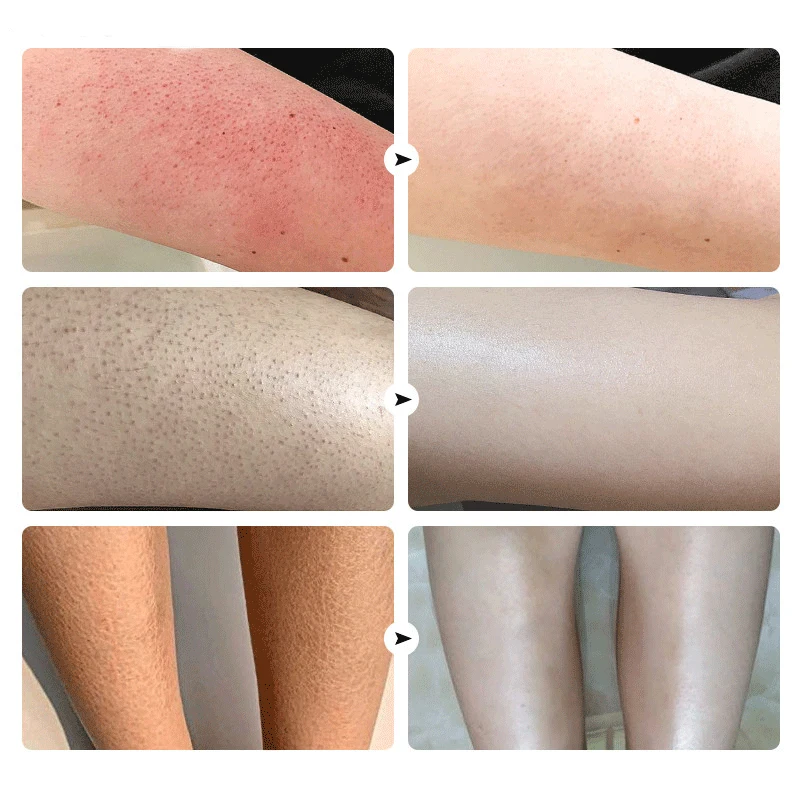 Slide image 7eb7e71138d14c41a5c8cc2e657edc0e