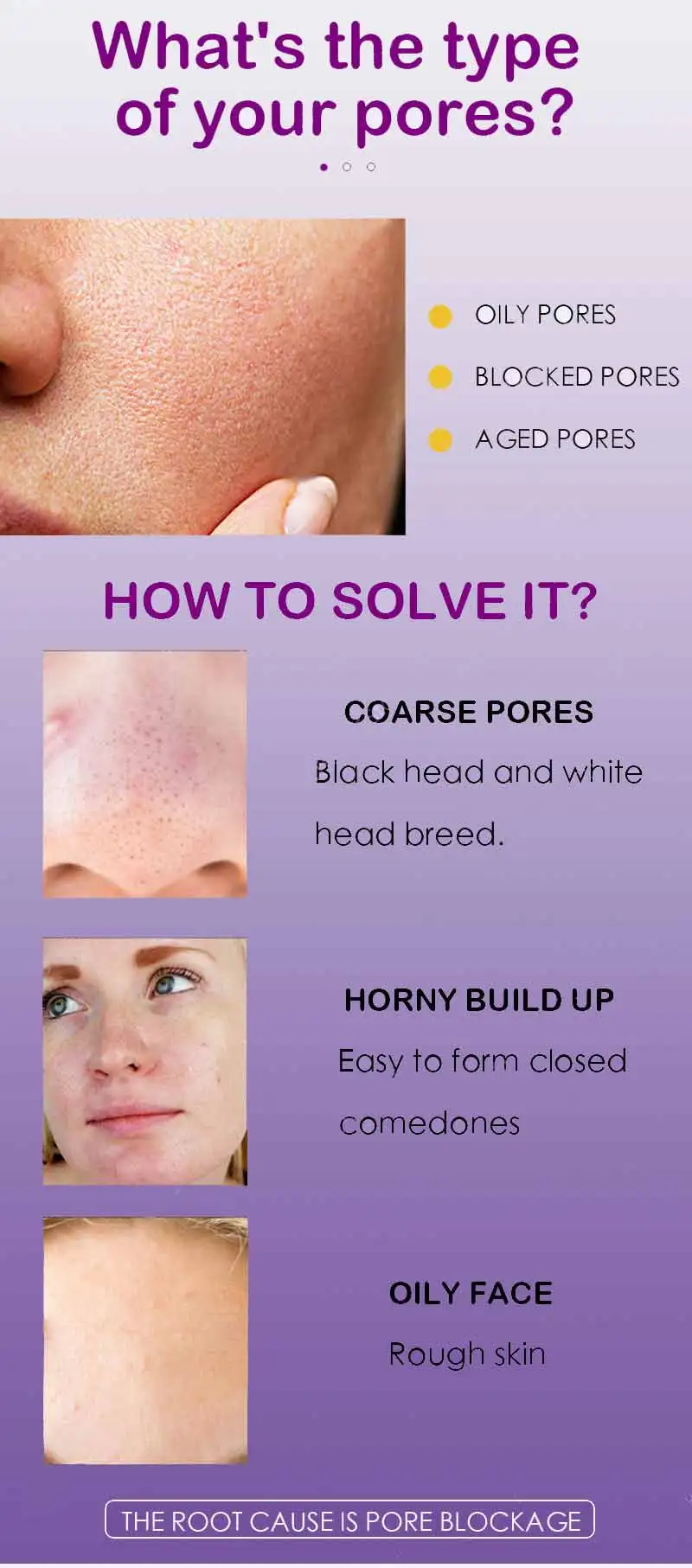Description Picture 3 of itemPore Skin Care Serum Facial Essence for Shrinking Pores Relieving Dryness Moisturizing Oil Control Firming
