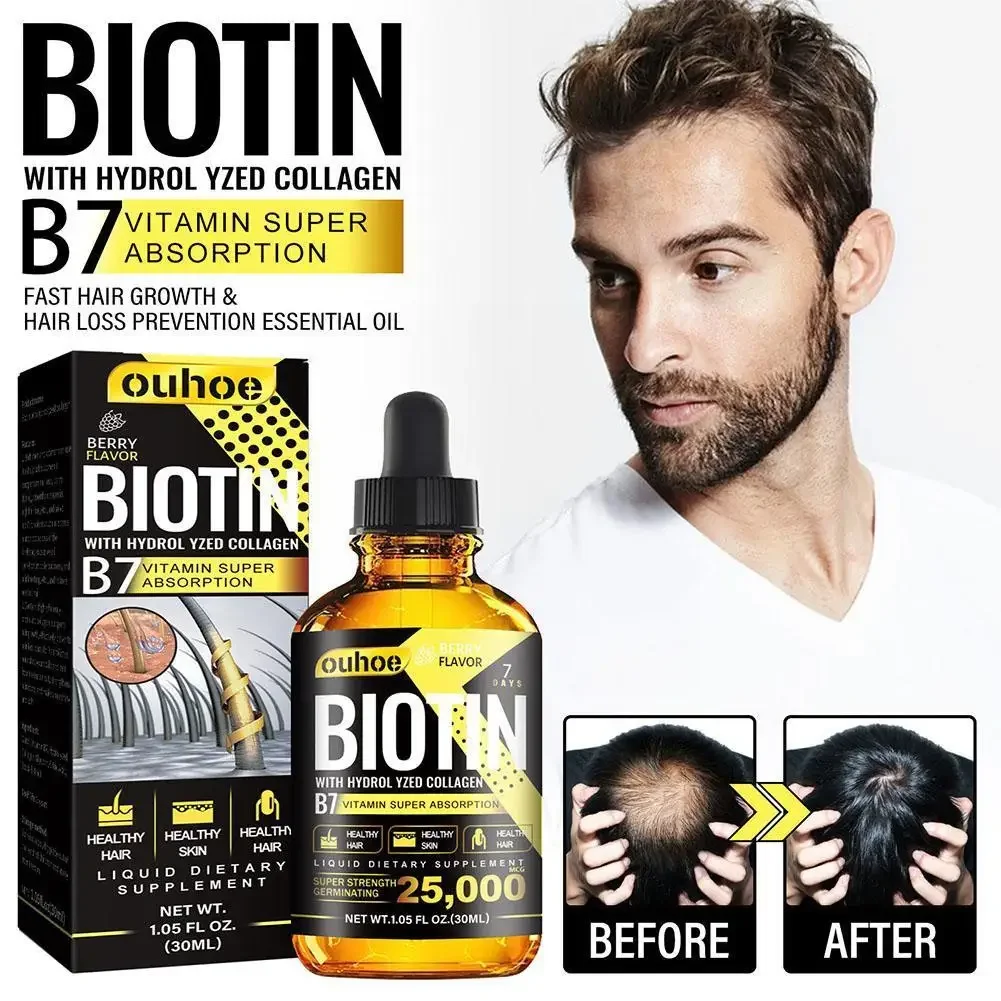Products Biotin Fast Growing Hair Care Essential Oils Anti Hair Loss Spray Scalp Treatment For Men Women 30ml